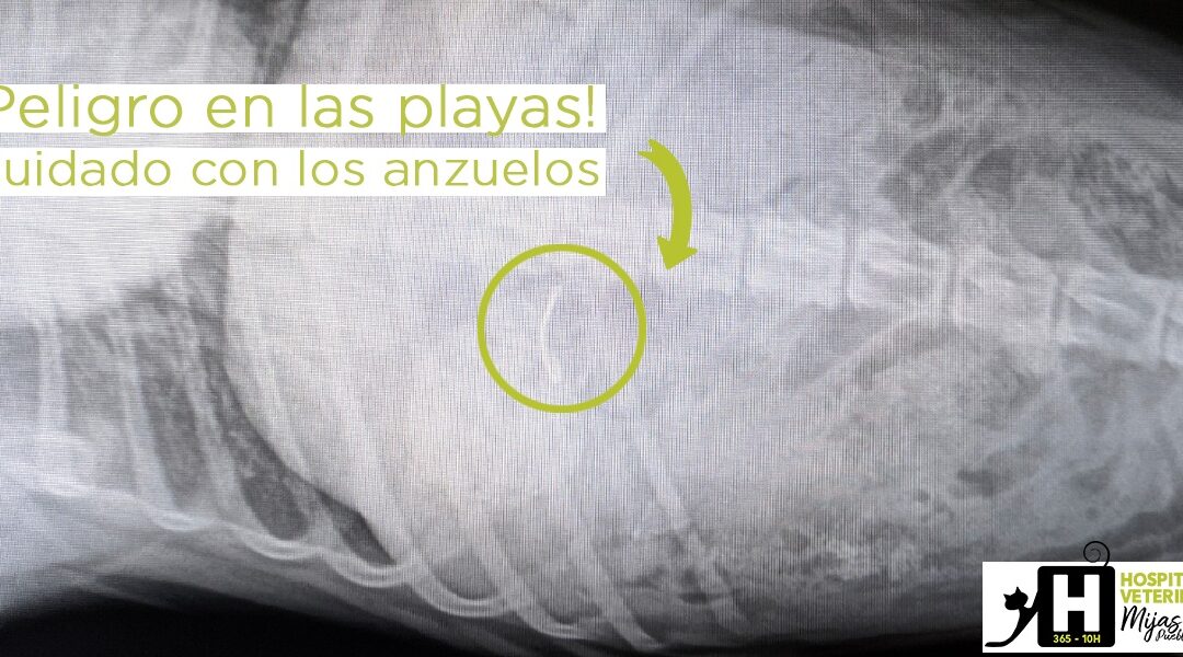 Los anzuelos y los hilos, un peligro en la playa.